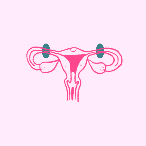 Laqueadura: o que é e o que você precisa saber